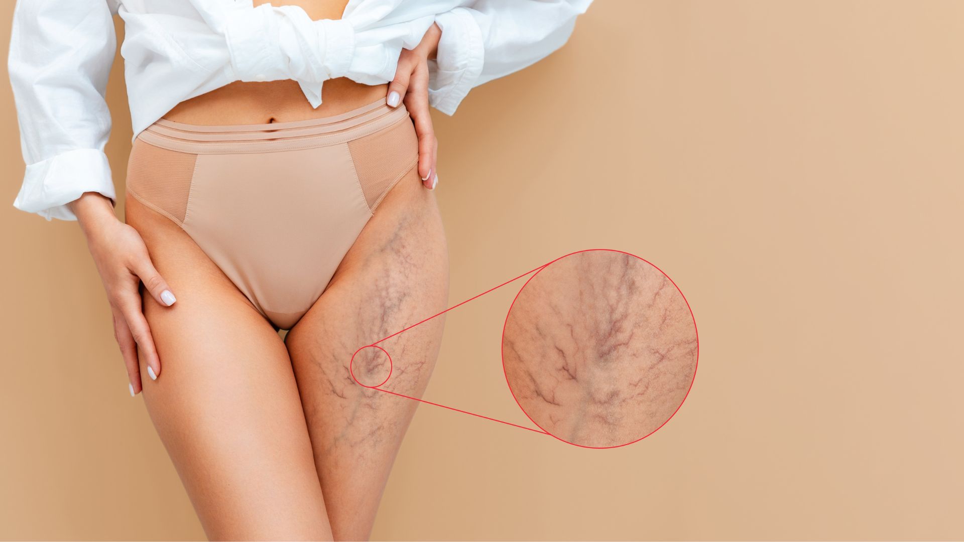 Come applicare correttamente una medicazione avanzata su una lesione trofica