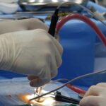 Cliniche specializzate in trattamento della trombosi venosa profonda vicino a me