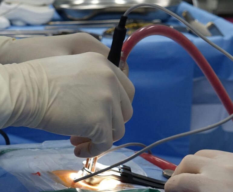 Cliniche specializzate in trattamento della trombosi venosa profonda vicino a me