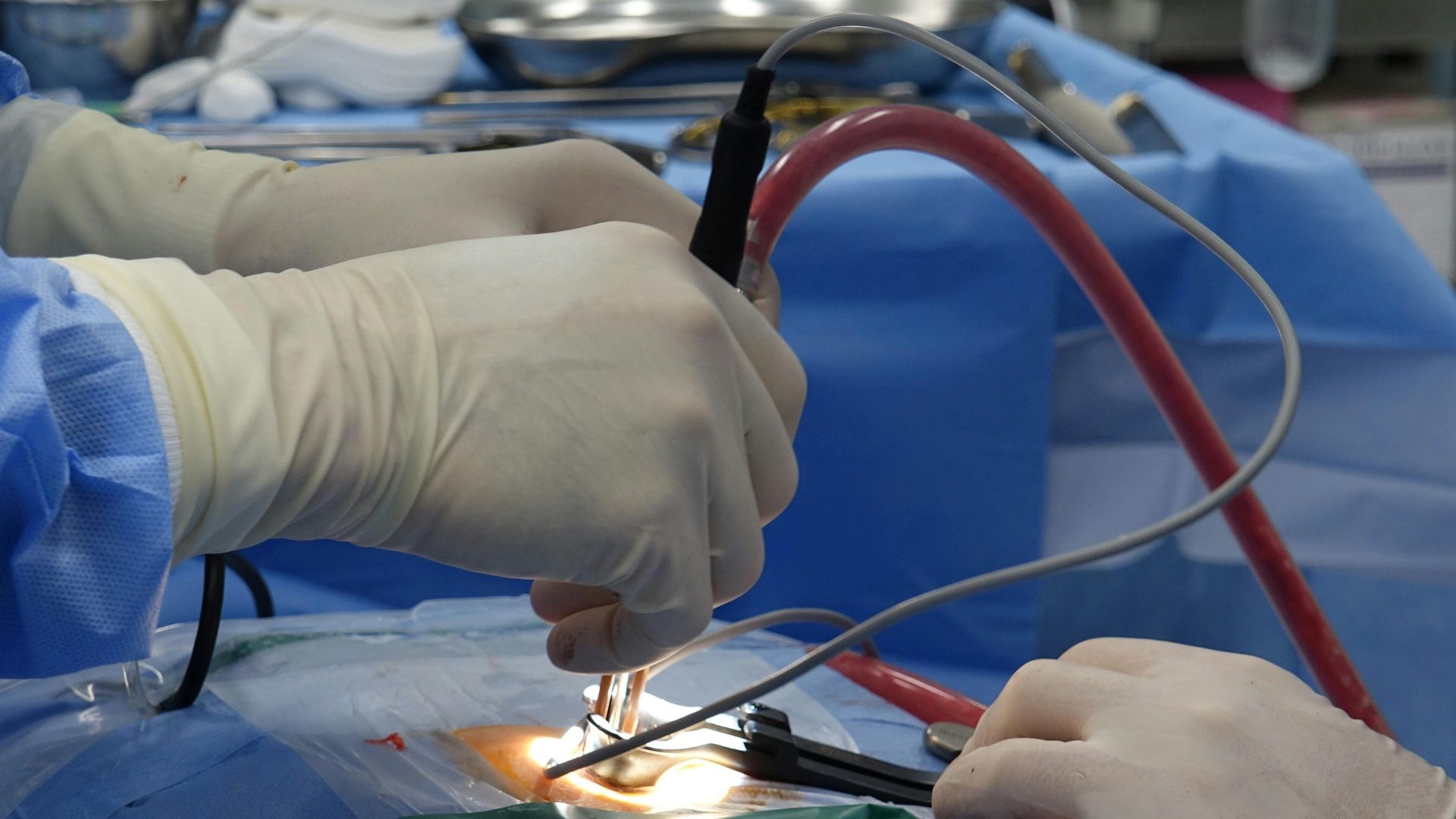 Cliniche specializzate in trattamento della trombosi venosa profonda vicino a me