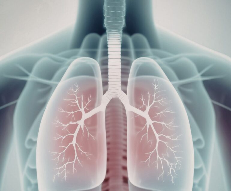 sindrome dello stretto toracico sintomi
