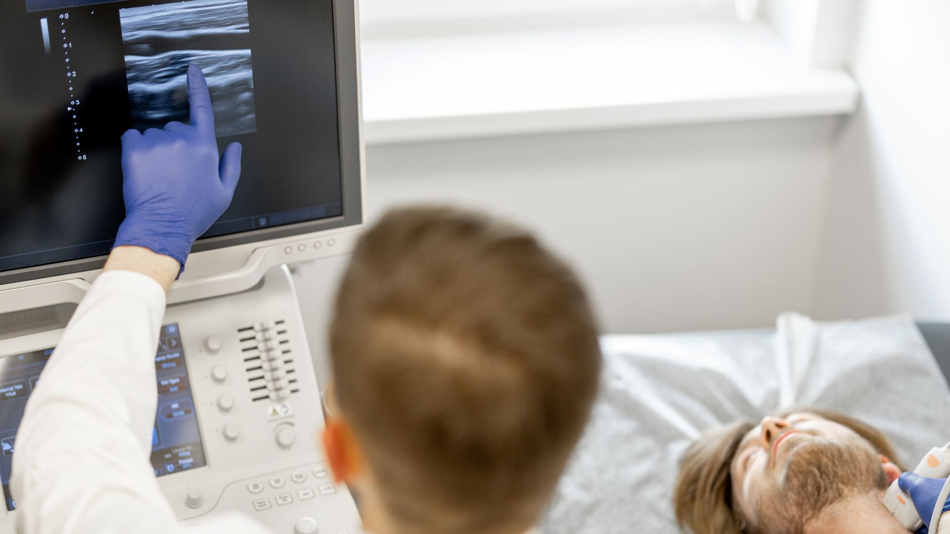 stenosi carotidea quando operare